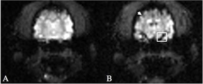 Dynamic Susceptibility Contrast Magnetic Resonance Imaging Protocol of the Normal Canine Brain